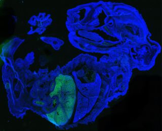 This mouse-human chimera shows human cells (green) in a 17-day-old mouse embryo (blue) that are mostly red blood cells accumulated in the mouse's liver.