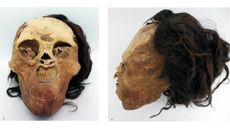 These photos show the partially mummified remains of the woman whose face was mutilated. Notice how the skin around her mouth was pulled upward.