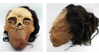 These photos show the partially mummified remains of the woman whose face was mutilated. Notice how the skin around her mouth was pulled upward.