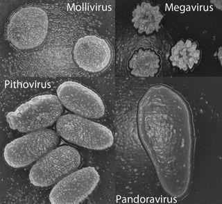 These scanning electron microscopy images show particles of the four families of giant viruses now known: from the largest, spanning 0.6 microns (Mollivirus) to the smallest, at 1.5 microns (pandoravirus).