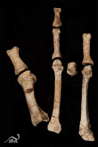 The Burtele partial foot shown after cleaning and preparation. It is shown here in its anatomically articulated form.