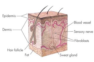 cross-section showing layers of skin