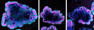 Human brain organoids (left) grew much bigger than gorilla organoids (middle) and chimpanzee organoids (right). Here the organoids are shown at 5 weeks old.