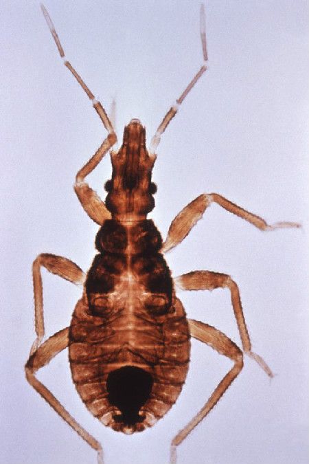 Kissing bugs, like this one, spread a parasitic infection known as Chagas disease. 