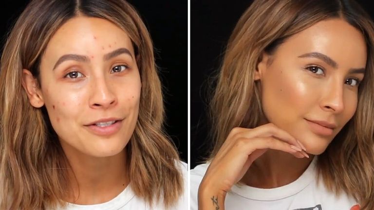 This Beauty Vlogger's Trick for Hiding Zits Is Honestly Freaking Genius