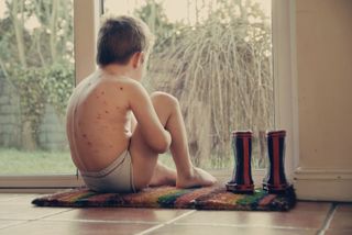 A boy with chickenpox sitting on the floor and looking out a window