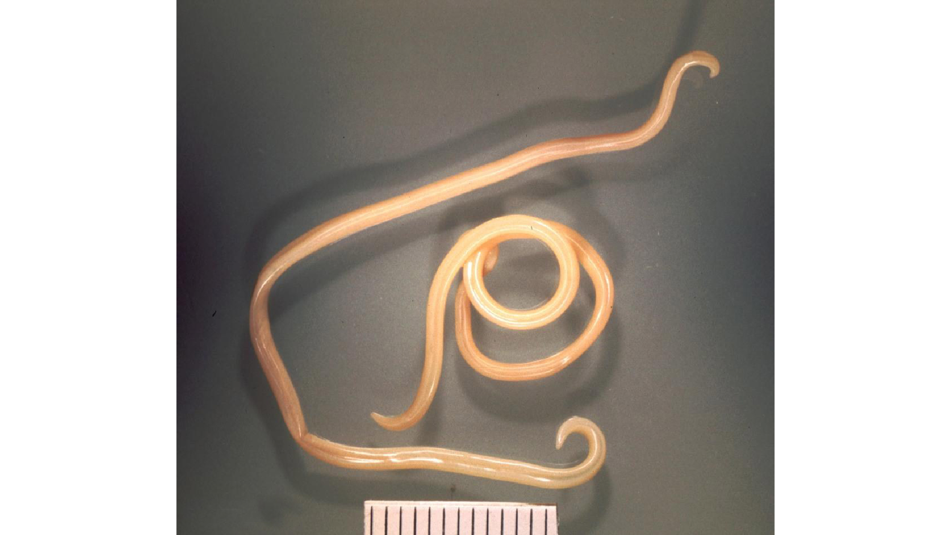 a photo of Toxocara canis adult nematode worms from a dog