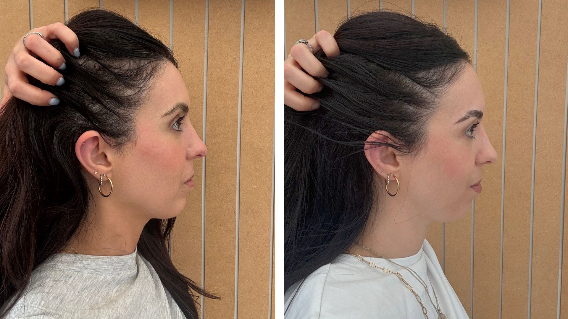Before and after of beauty editor using K18 FutureIQ&amp;trade; Biomimetic Hair Longevity Serum