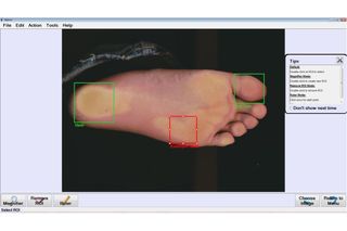 Users use scanners to capture the diagnostic image, placing their feet right on the screen.