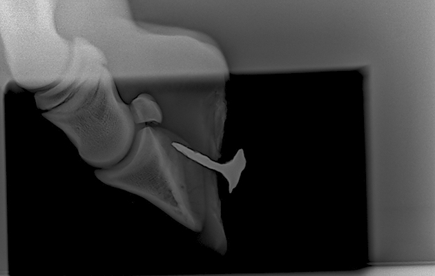 sheet nail in foal[1] Sheet nail in foot
