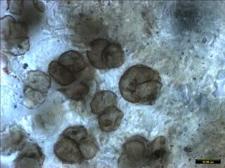 These clusters of cells are 1 billion years old, the oldest to appear in freshwater/land ecosystems. 