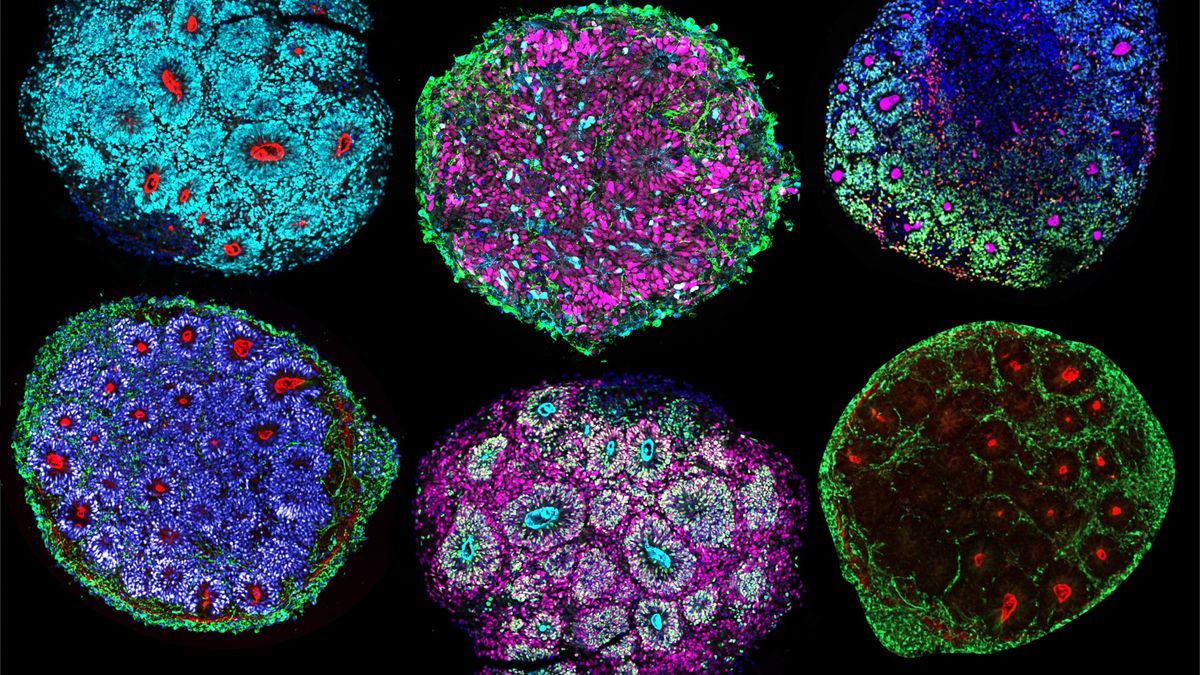 Scientists just grew the 1st-ever ‘minibrains’ from multiple people’s cells