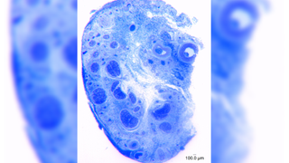 histological image shows a cross section of clitoral tissue, stained blue; bundles of nerve fibers look like clusters of blue dots