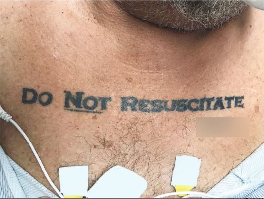 An image showing a patient with the words &quot;do not resuscitated&quot; tattooed on his chest.