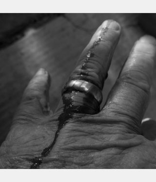 black and white image of bleeding hand by Larry Fink