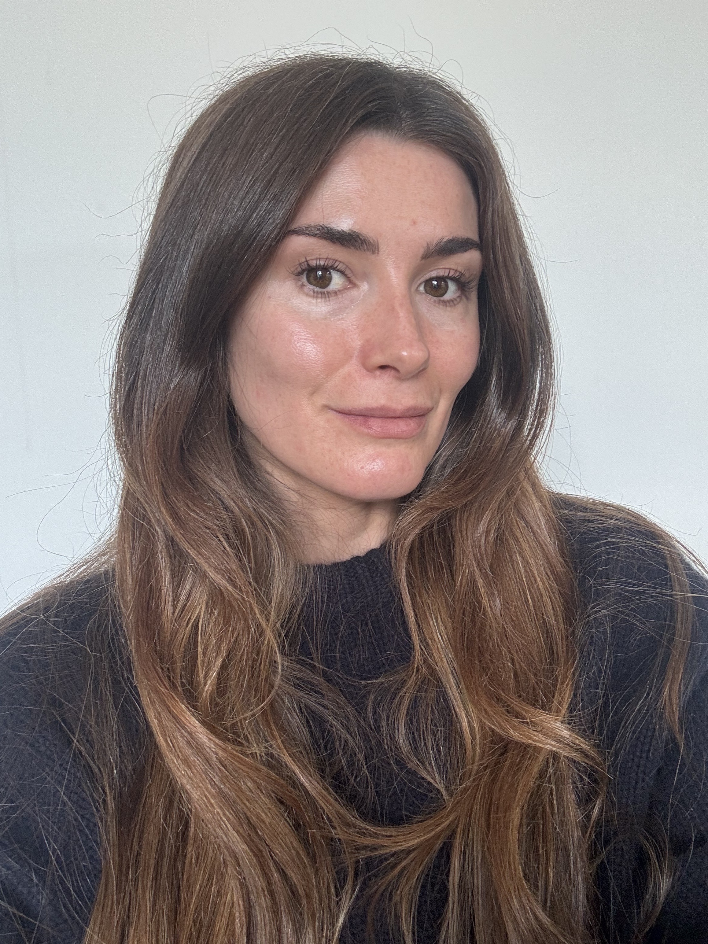 Eleanor before using Caudalie Vinoperfect serum