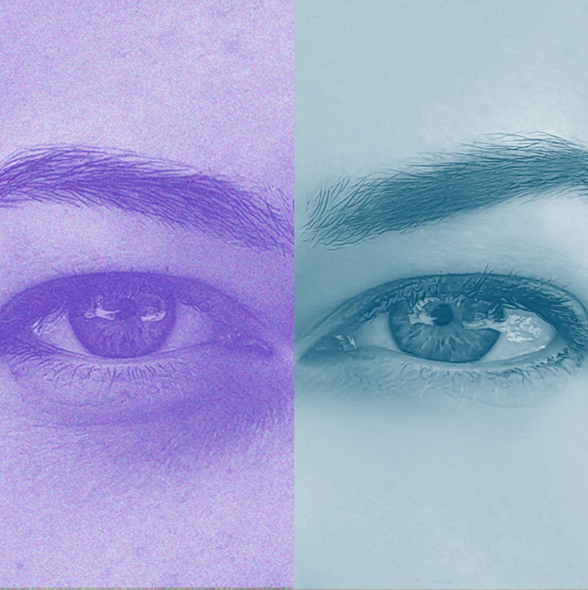 Under Eye Filler Art