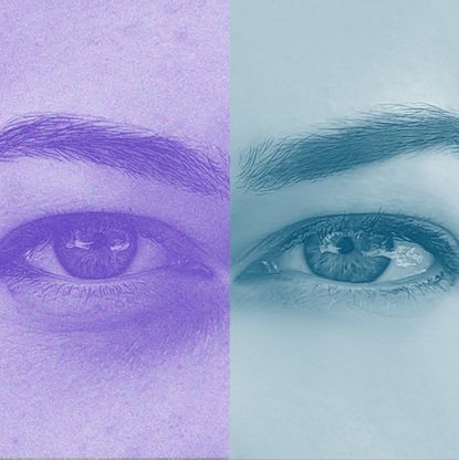 Under Eye Filler Art