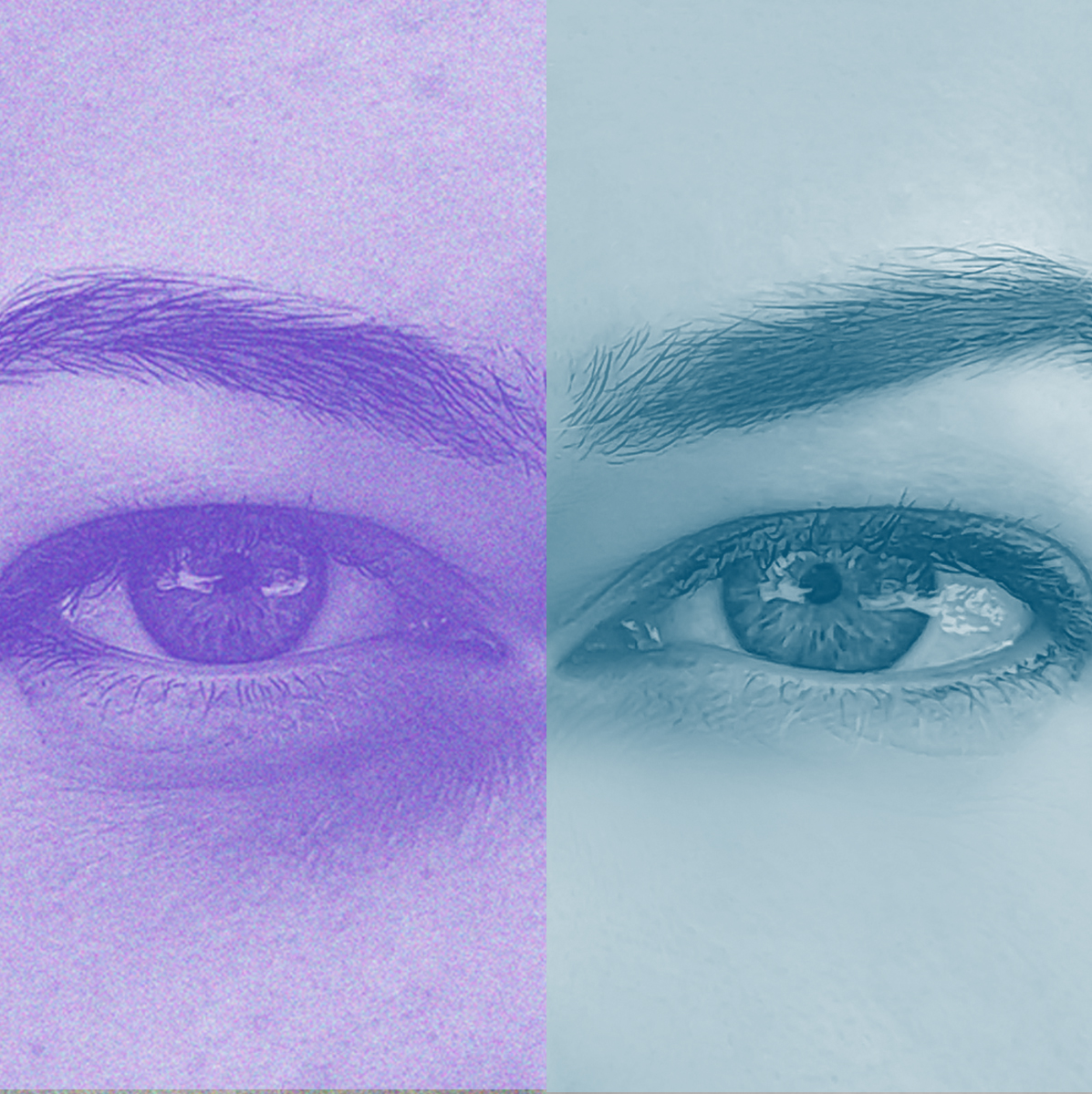 Under Eye Filler Art