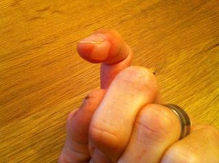 Be careful with those CO2 cartridges or you might end up with a blistered finger like Colby Pearce.