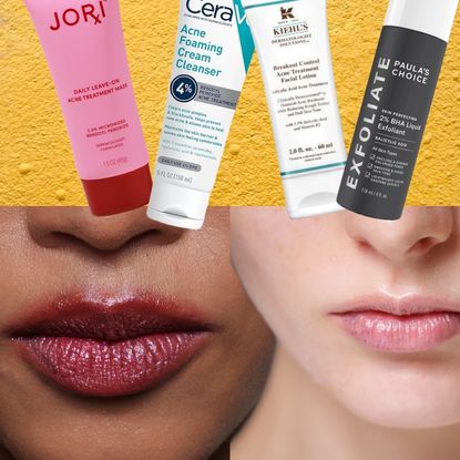 a collage of two women's mouths close up over a bumpy yellow background with bottles of skincare for hormonal acne products at the top