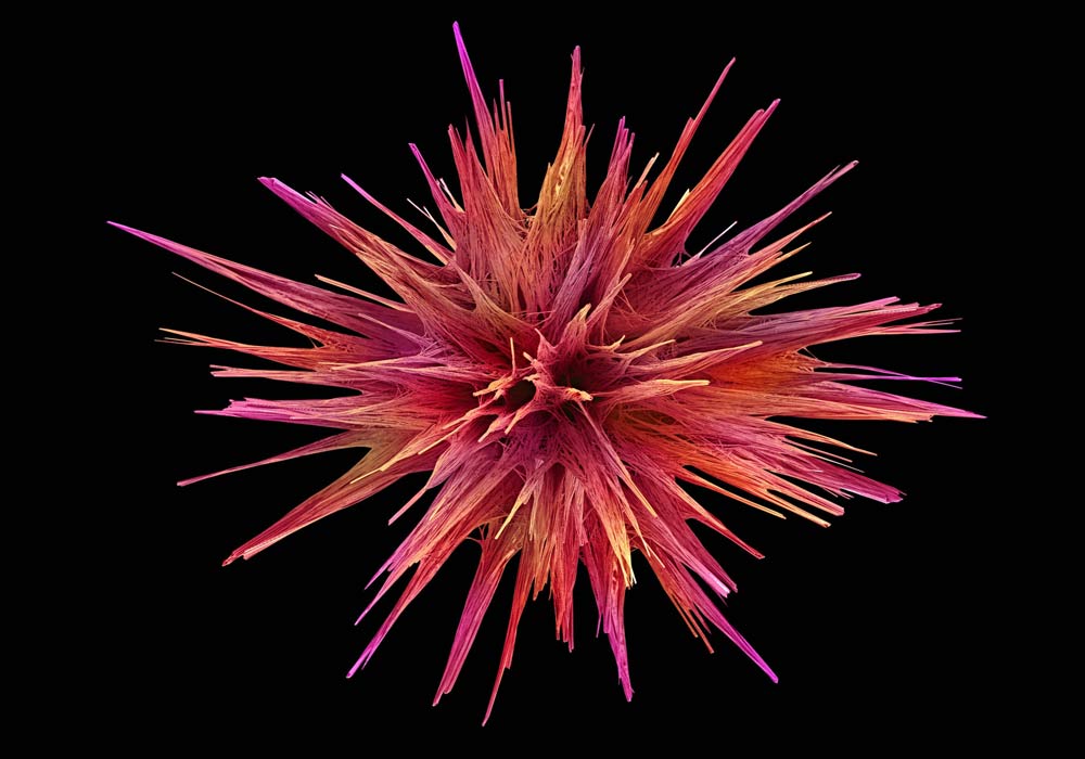 Scanning electron micrograph of loperamide crystals.