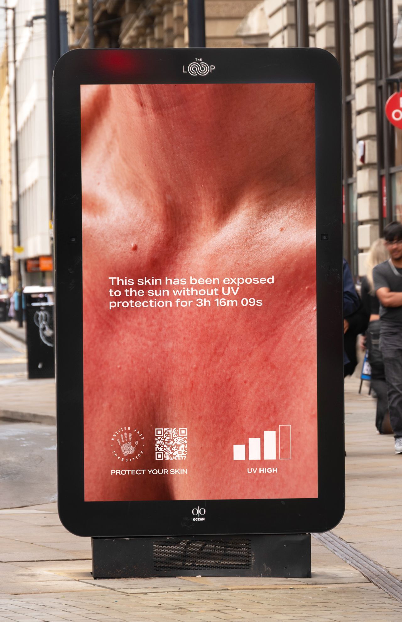billboard showing sun damage to skin