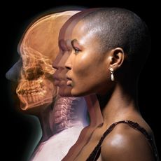 a woman with glowing skin on a black background next to an X-ray of a skull