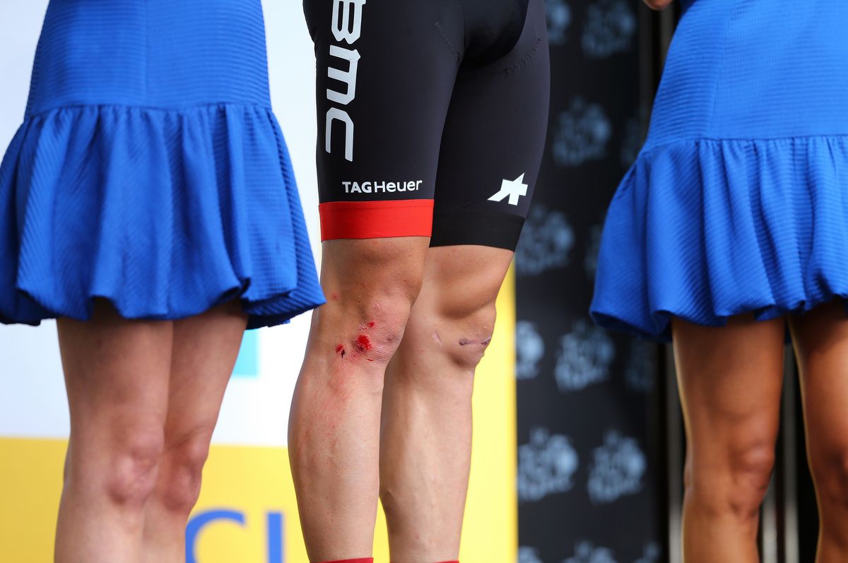 The bloody knee of Stefan Kung on the stage 2 podium