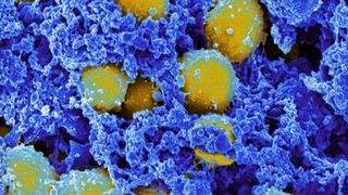 this digitally colorized, scanning electron microscopic (SEM) image, depicts a clump of yellow-colored, spheroid shaped, Staphylococcus aureus bacteria that were enmeshed in a blue-colored, filamentous extracellular matrix