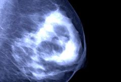 Mammogram