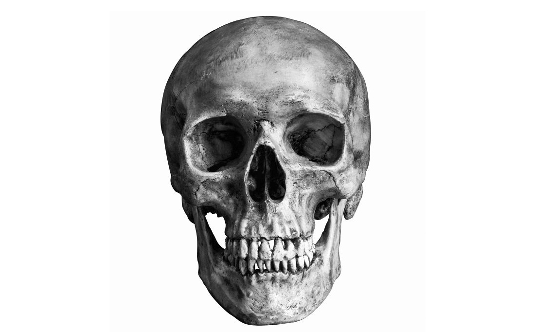 Image of a human skull

