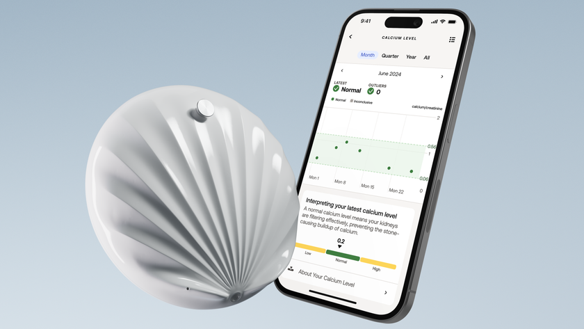 Render of the Withings U-Scan Calci device next to an iPhone with the Withings app showing a Calcium widget.