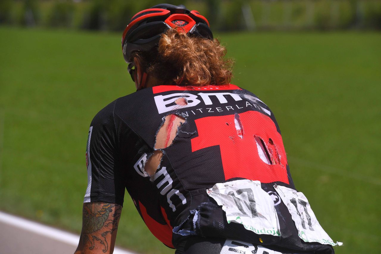 Daniel Oss (BMC) showing the effects of a crash