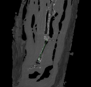 The left tibia (leg bone) is shown here in green.