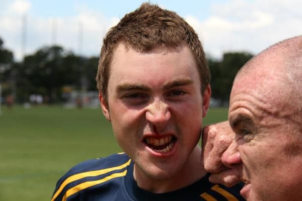 Leigh Howard cops a blood nose