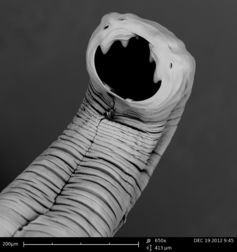 A hookworm makes its home in your gut.
