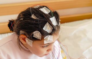 External electrodes can record a brain's activity.