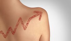 A drawing of a measles rash on an adult's back in the shape of an arrow trending upward.