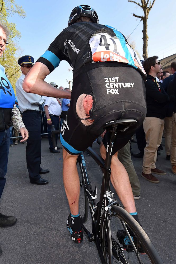 Chris Froome (Team Sky) at the finish after his crash.