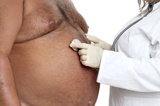 A doctor holds a stethoscope to the chest of an obese patient.