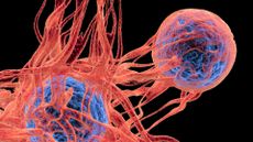 illustration of two cancer cells surrounded by stringy tendrils
