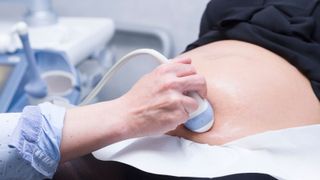 close up on a health care provider's hand as she places an ultrasound device on a pregnant person's exposed stomach