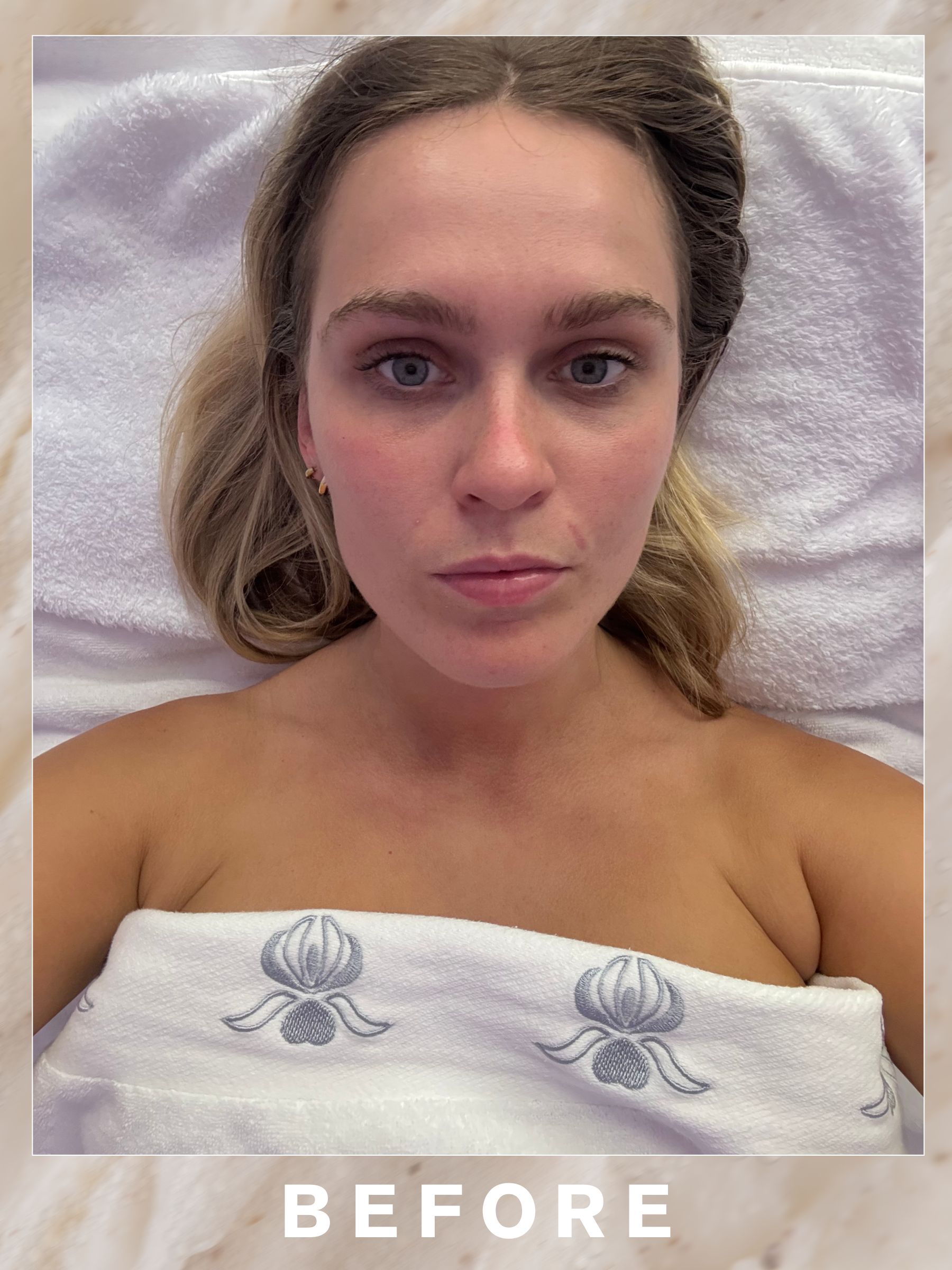 Annie before her Sisley Signature Facial