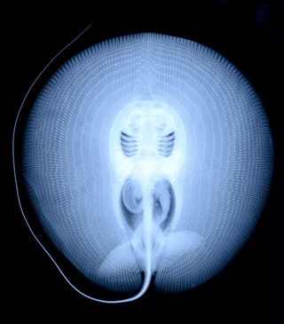 X-ray of Heliotrygon gomesi, preadult male.
