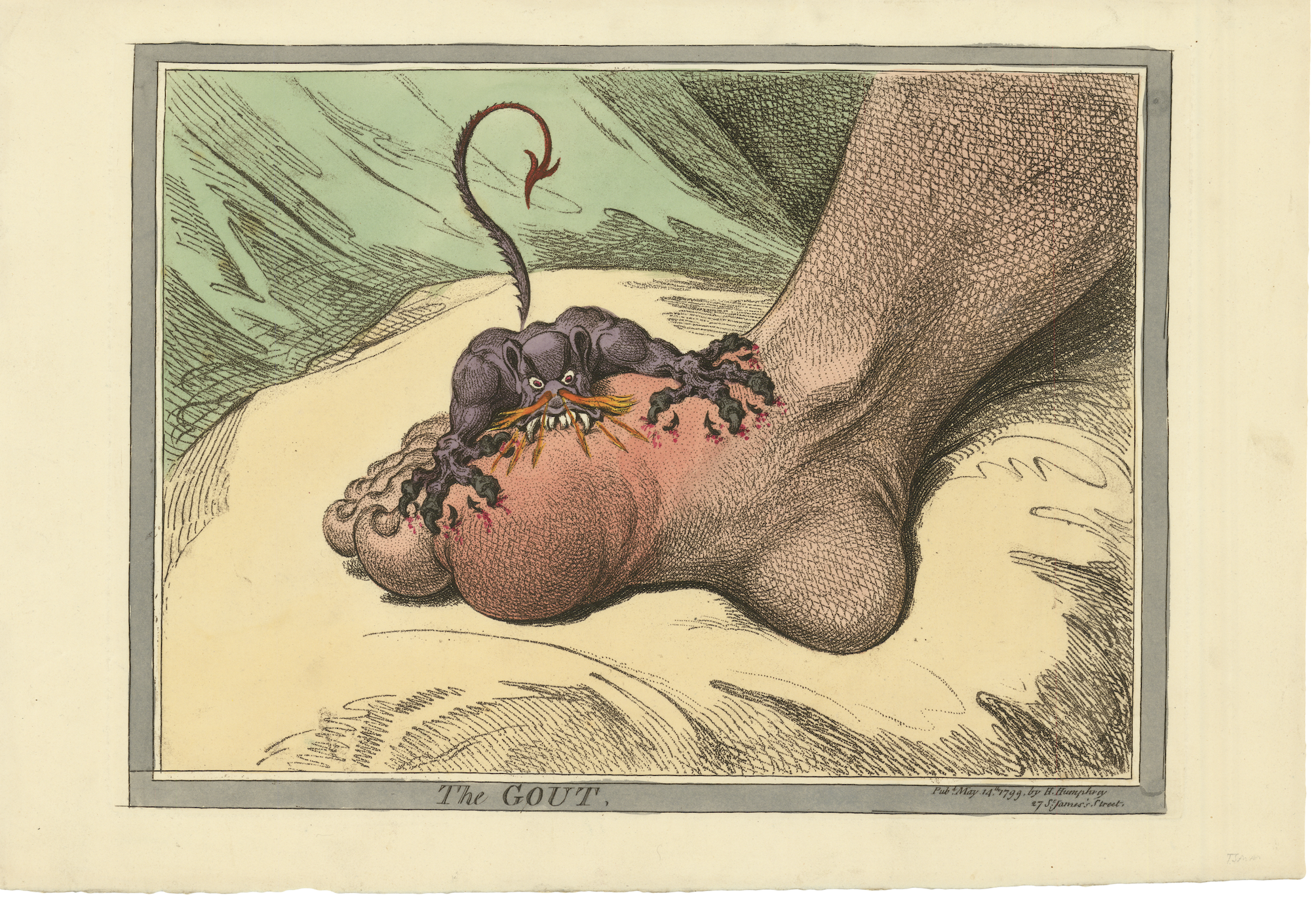 the gout picture