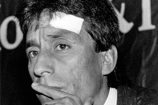 Chile goalkeeper Roberto Rojas at a press conference in 1989, following the controversial incident in Brazil in which he claimed he had been hit by a firework on the pitch in a World Cup qualifier between Brazil and Chile.