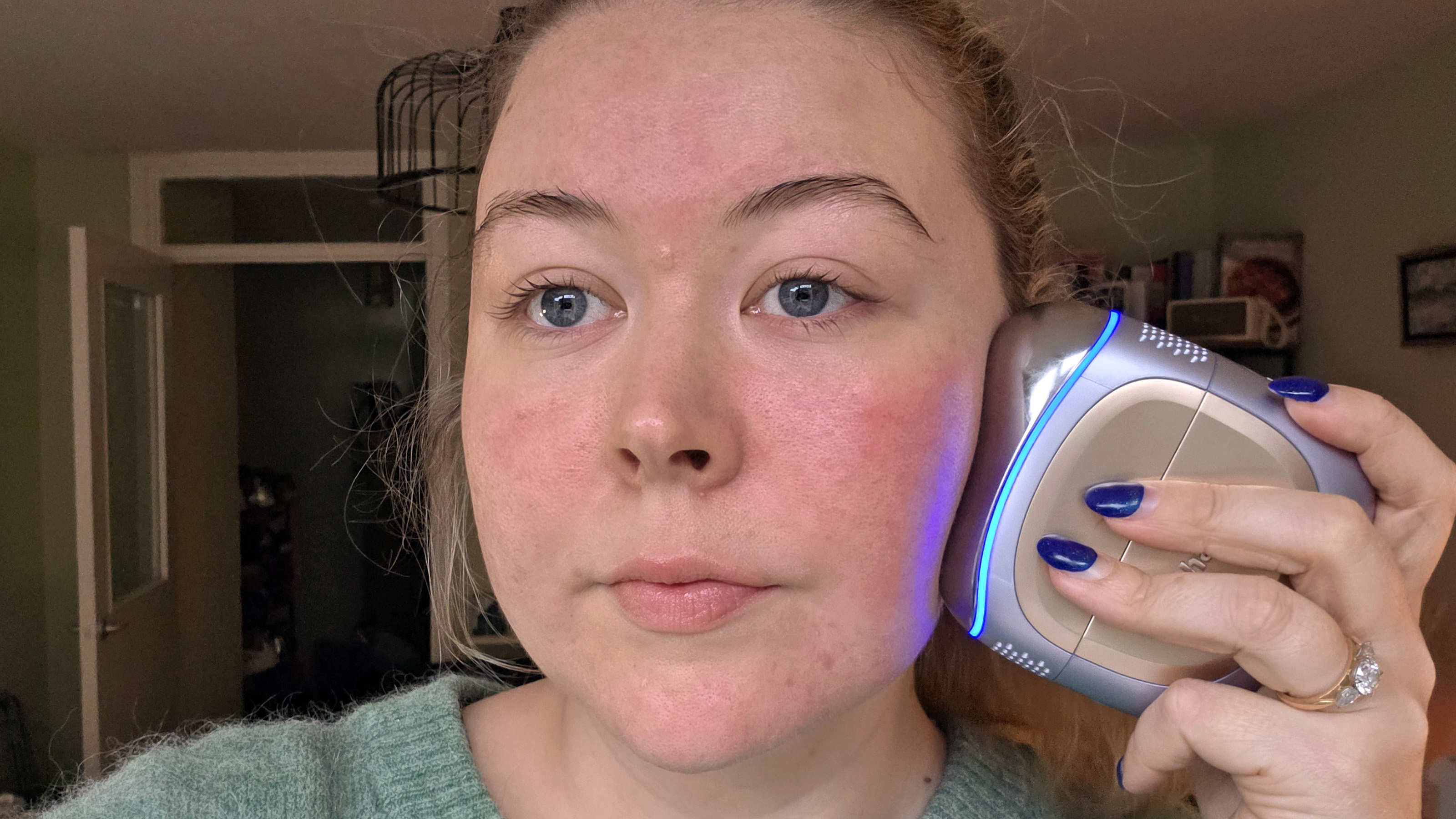 Shark FacialPro Glow