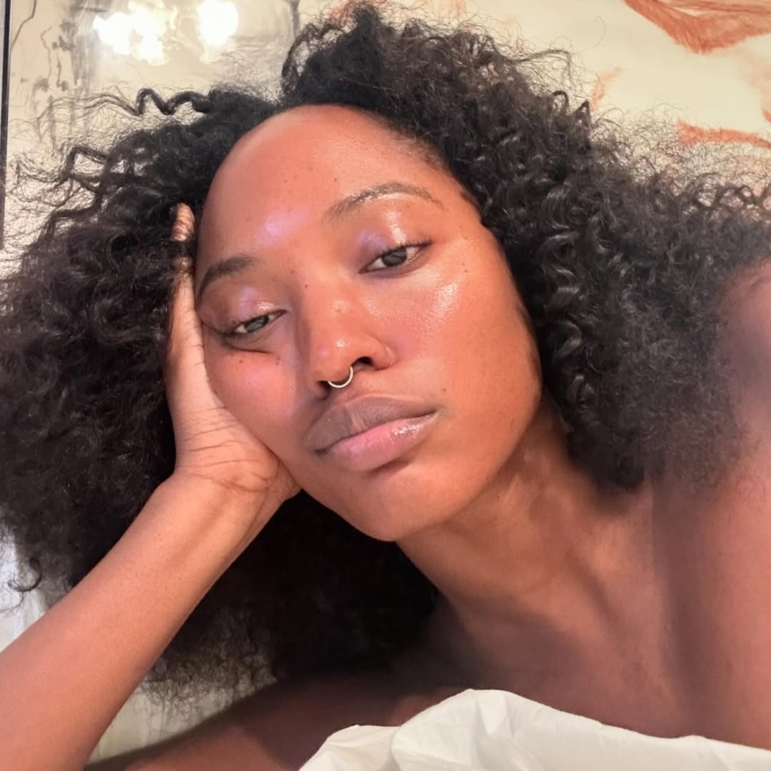 Image of a woman with clear, hydrated skin.