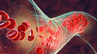 A 3D rendering of red blood cells traveling through a narrow vein or artery